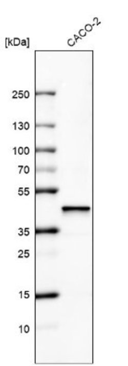 alpha-Methylacyl-CoA Racemase/AMACR Antibody (CL9362), Novus Biologicals